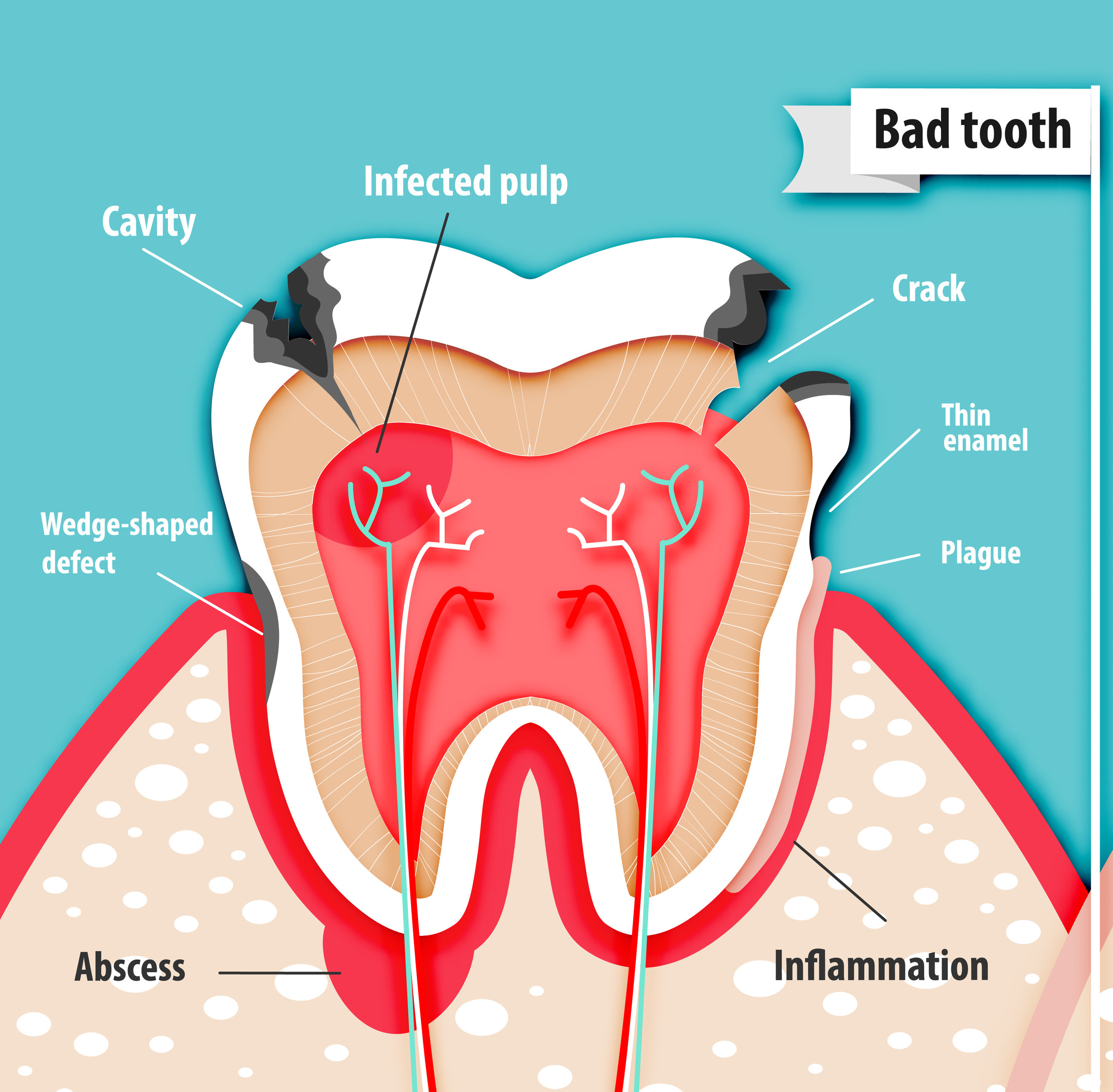 A tooth with problems