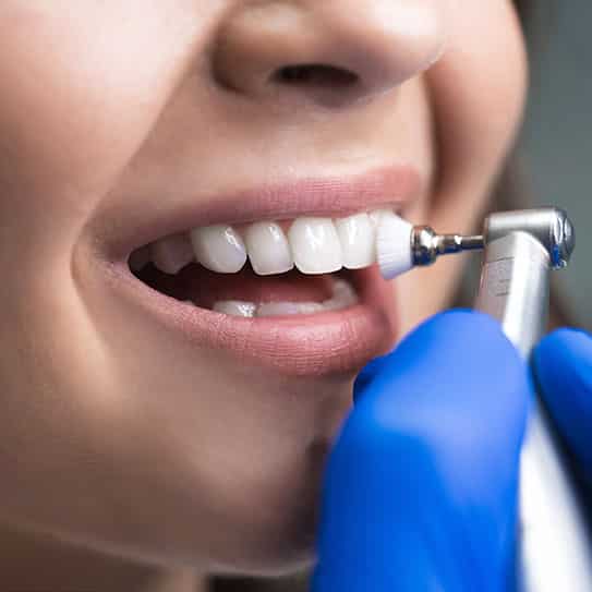 dental cleaning