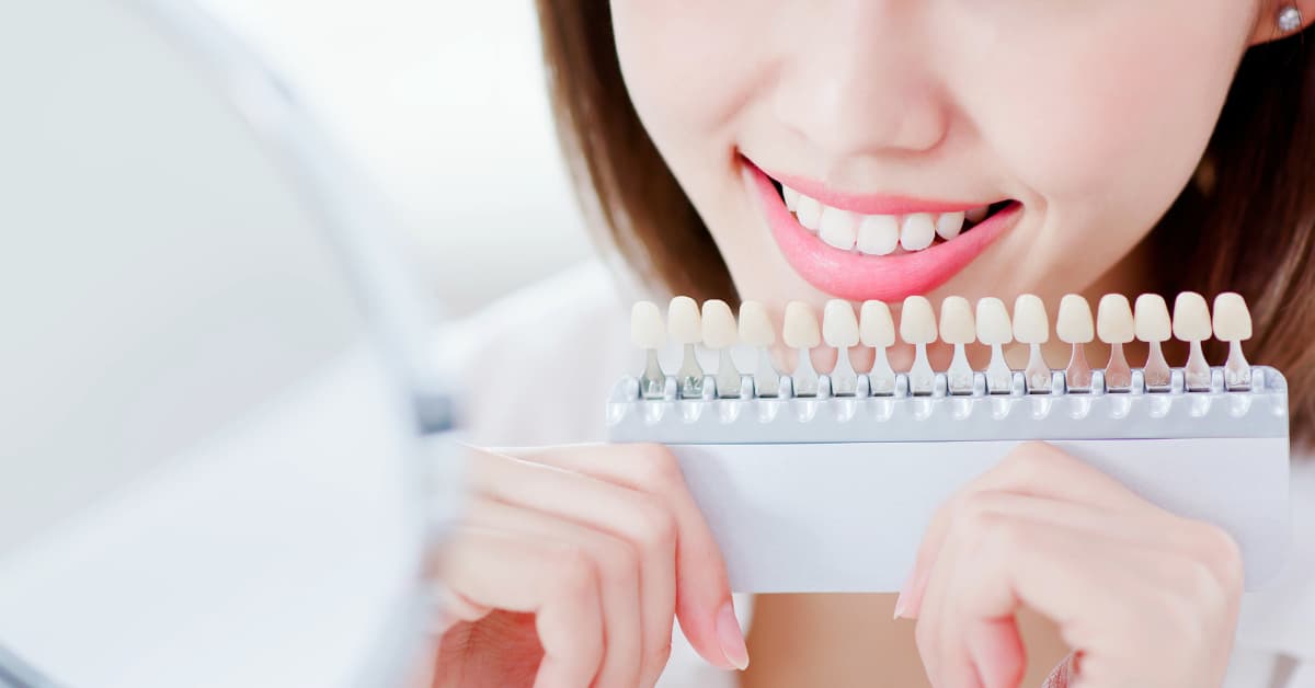 Professional teeth whitening options