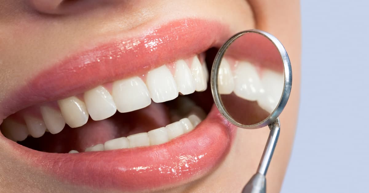 composite bonding teeth dental services