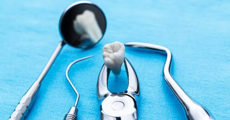 wisdom tooth removal cost breakdown