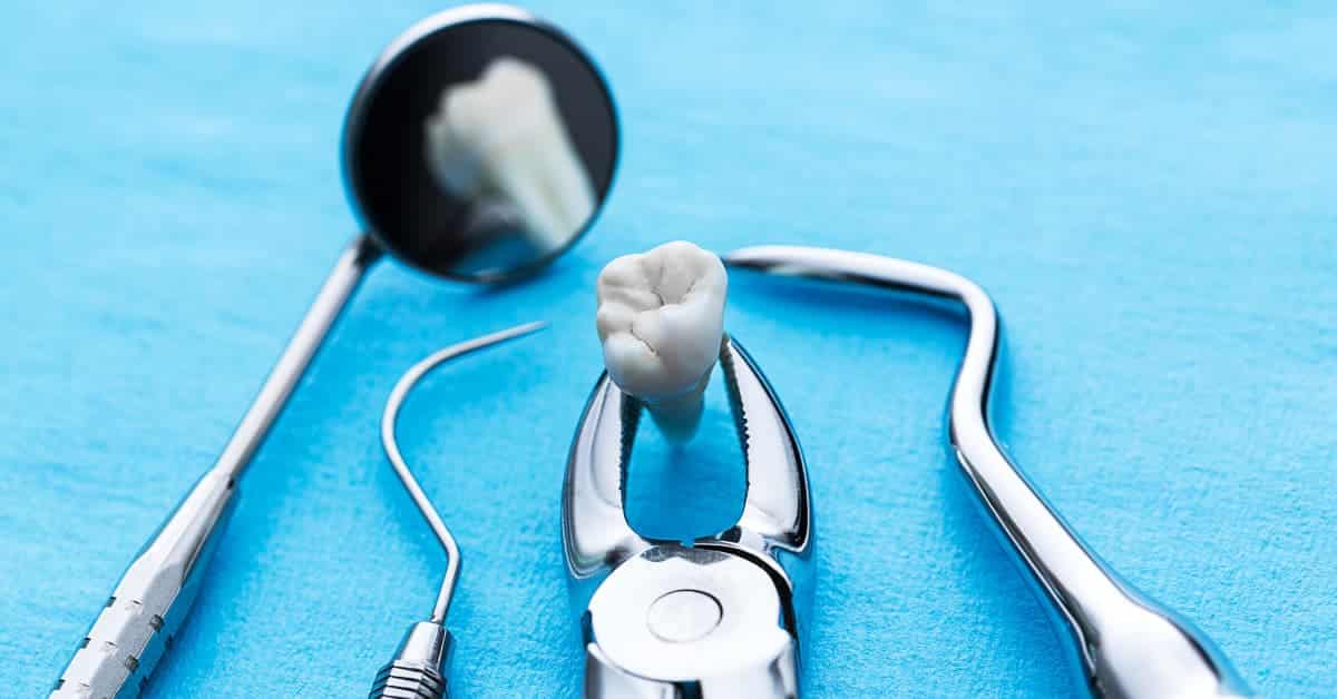 wisdom tooth removal cost breakdown