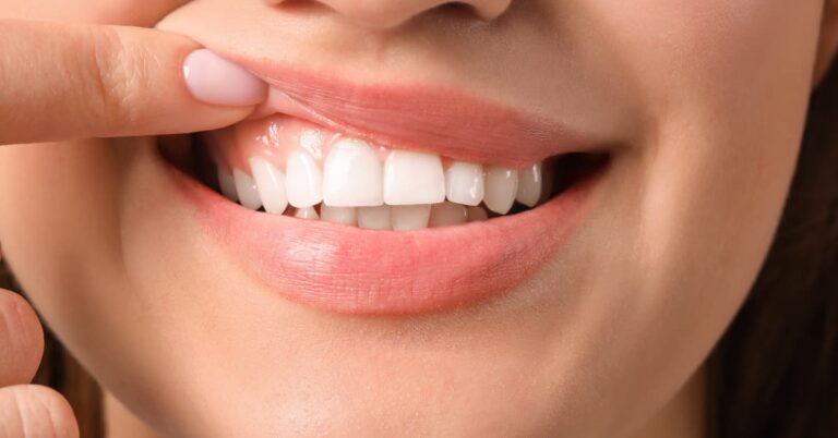 Learn how to fix receding gums