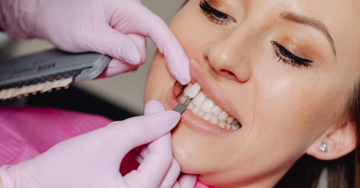 Actual crown vs veneer cost breakdown