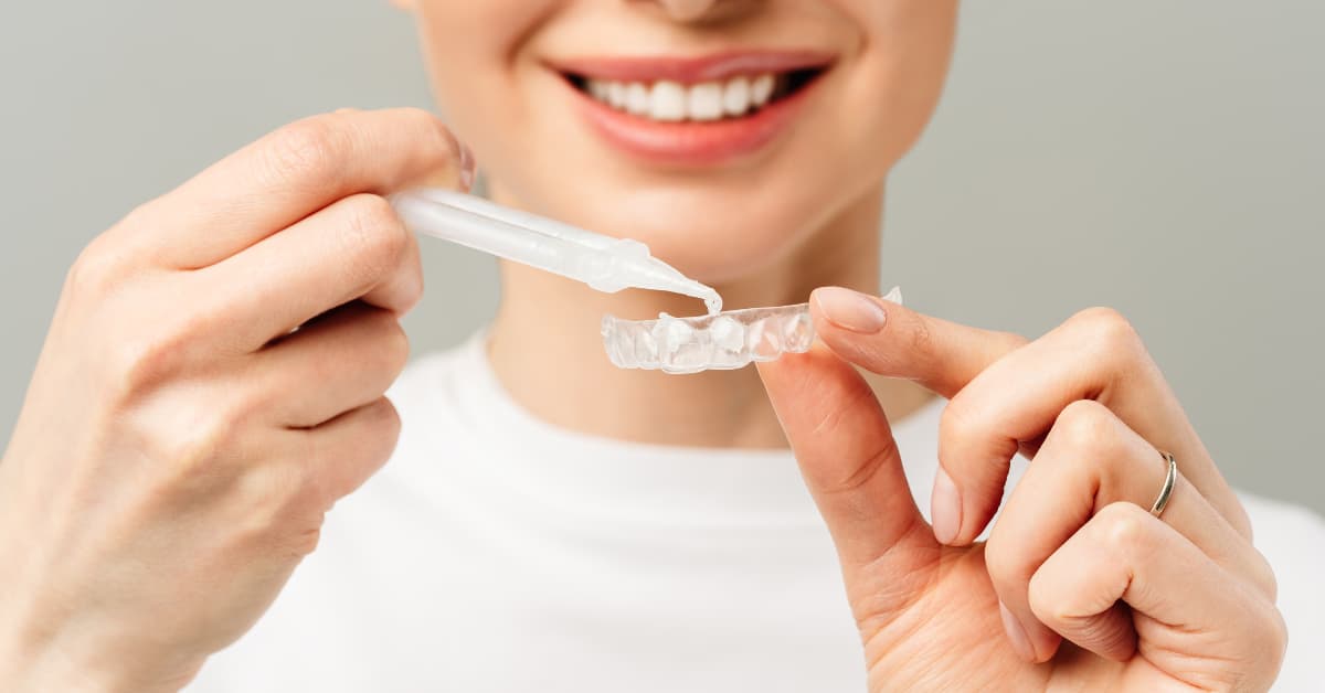 Professional pregnancy-safe teeth whitening
