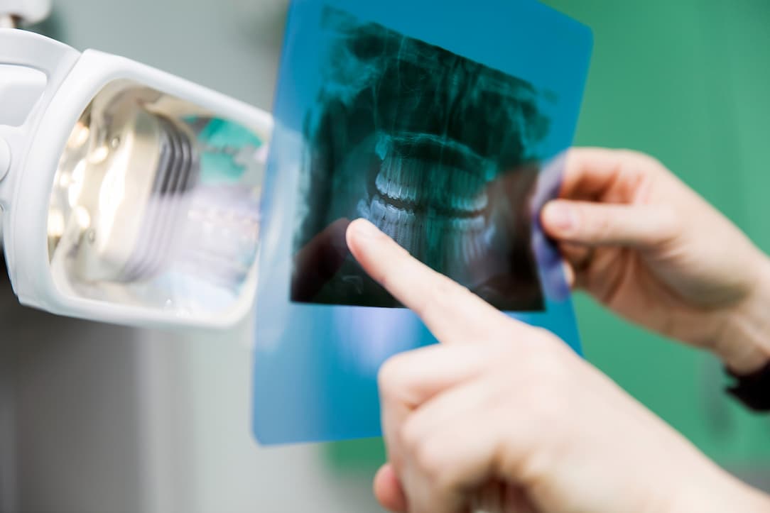 Dentist reviewing dental imaging for implant planning