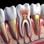 Tooth Sensitivity Treatment: Finding Real Relief That Lasts