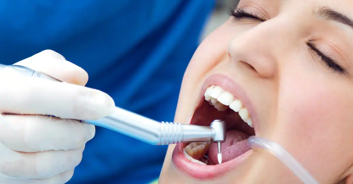 Frequent Dental Cleanings Guide
