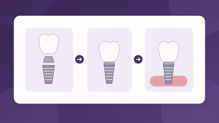 Best Same-Day Dental Implants in Las Vegas: What to Expect and Who Qualifies