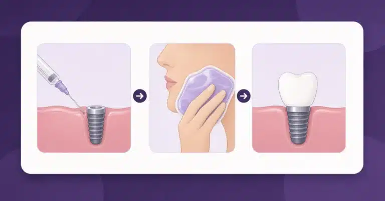 Do dental implants hurt: local anesthesia during placement, an ice pack in the first 48 hours, and a healed implant crown